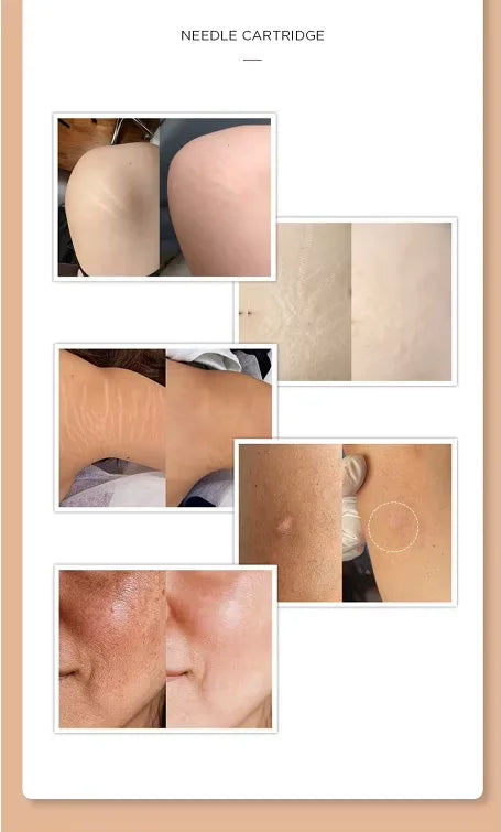 10ML Skin Camouflage Micro Pigment Permanent Makeup Ink Stretch Mark Camouflage Pigments Skin Tone Scar Camouflage Tattoo Ink