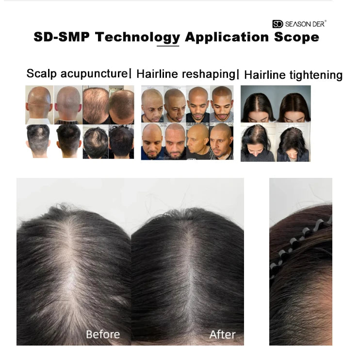 NUOJO Painless SMP Scalp Micropigmentation Machine PMU Micro Pigmentation Kit Scalp Tattoo Device Hair Tattoo Machine