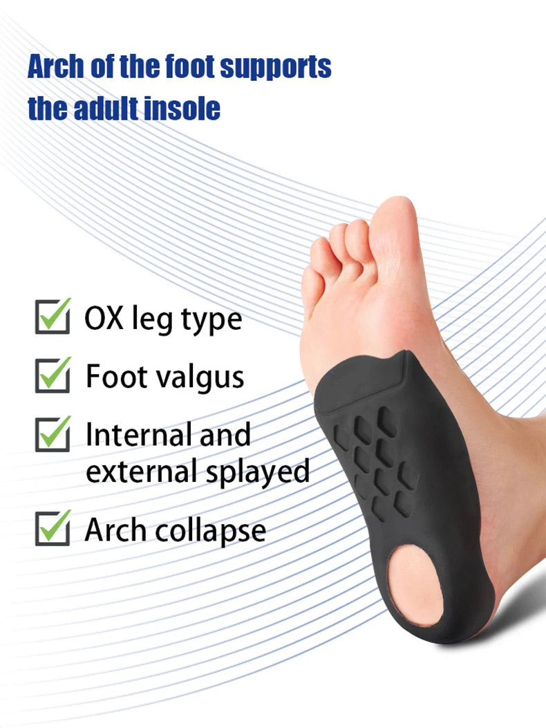 1Pair Flat foot O-shaped leg insoles (for shoes) Corrective arch support Plantar Fasciitis Relief men's and women's insoles
