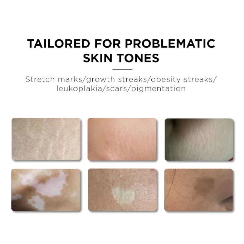 10ML Skin Camouflage Micro Pigment Permanent Makeup Ink Stretch Mark Camouflage Pigments Skin Tone Scar Camouflage Tattoo Ink