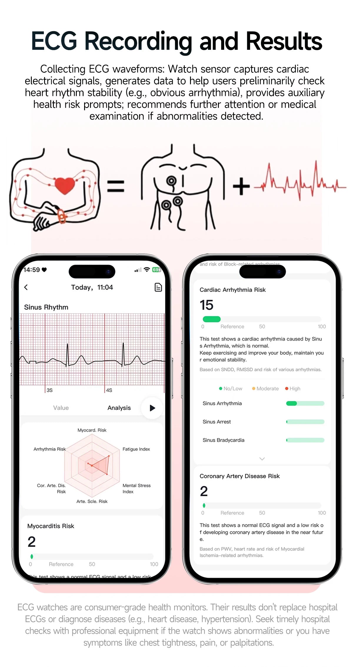 2026 ECG+PPG Daily Health Smart Watch Men Blood Fat Uric Acid Heart Rate Blood Oxygen Bluetooth Call Wellness Tracker Smartwatch