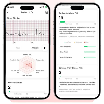 Nursing Grade New ECG+PPG Healthy Diagnose Smart Watch Men Body Analysis Blood Pressure Lipid Uric Acid NFC Health Tracker Watc