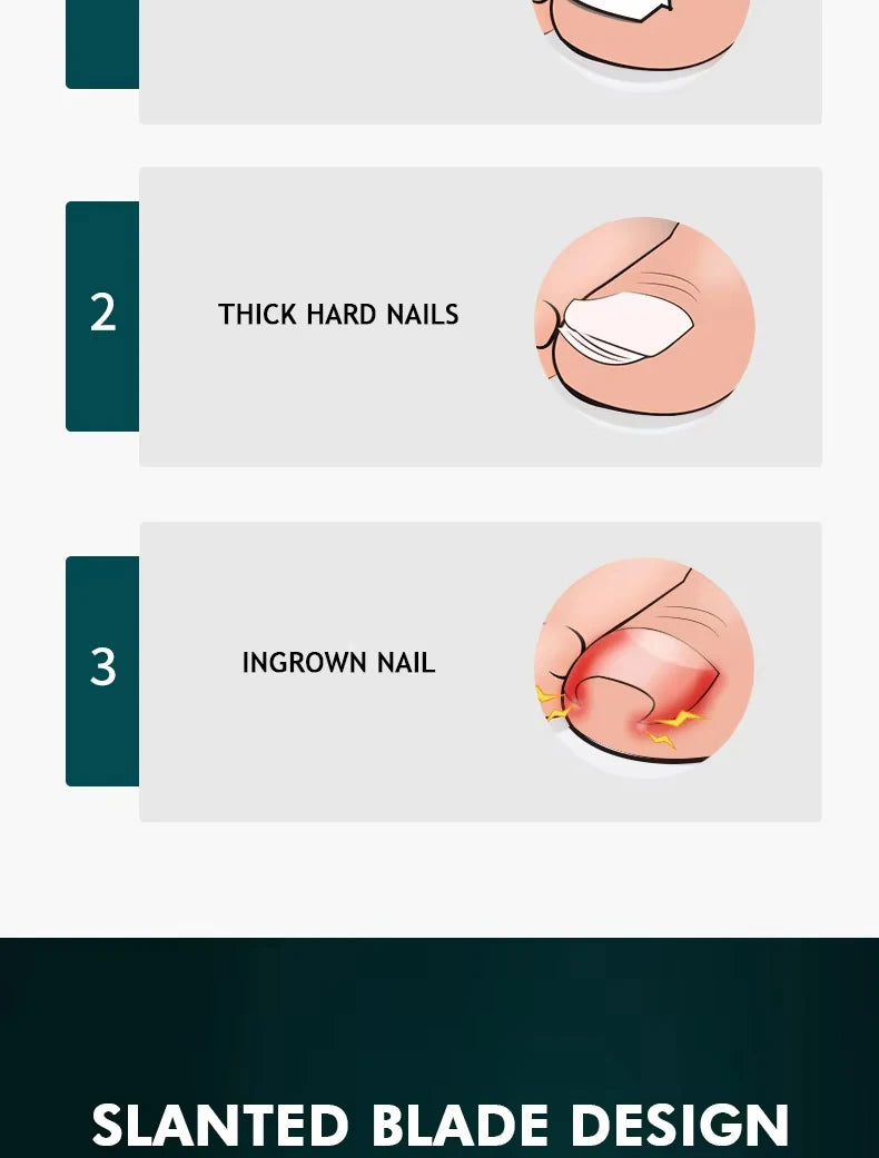 New Pointed-Nose, Beveled, Original Large-Opening Nail Clippers, Pointed-Nose Nail Cutters, Nail Trimmers, Household Pedicure Kn