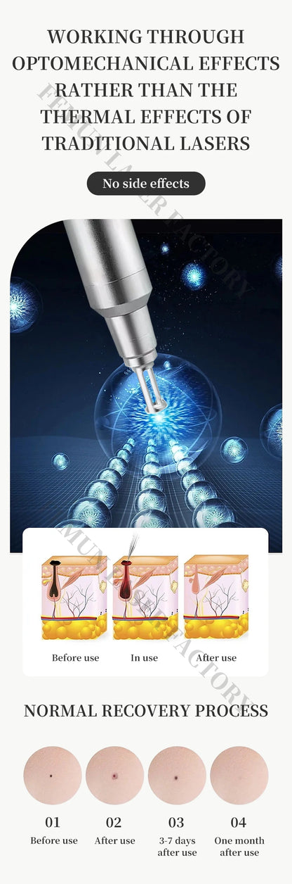 2026 NEO Pico Laser Tattoo Removal Machine Professional Q Switched Nd Yag System Beauty Salon Equipment for Dark Skin Treatment