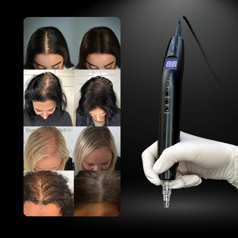 NUOJO Painless SMP Scalp Micropigmentation Machine PMU Micro Pigmentation Kit Scalp Tattoo Device Hair Tattoo Machine