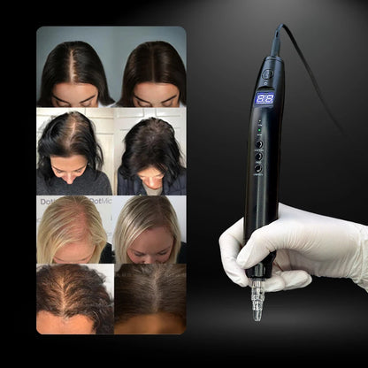 NUOJO Painless SMP Scalp Micropigmentation Machine PMU Micro Pigmentation Kit Scalp Tattoo Device Hair Tattoo Machine