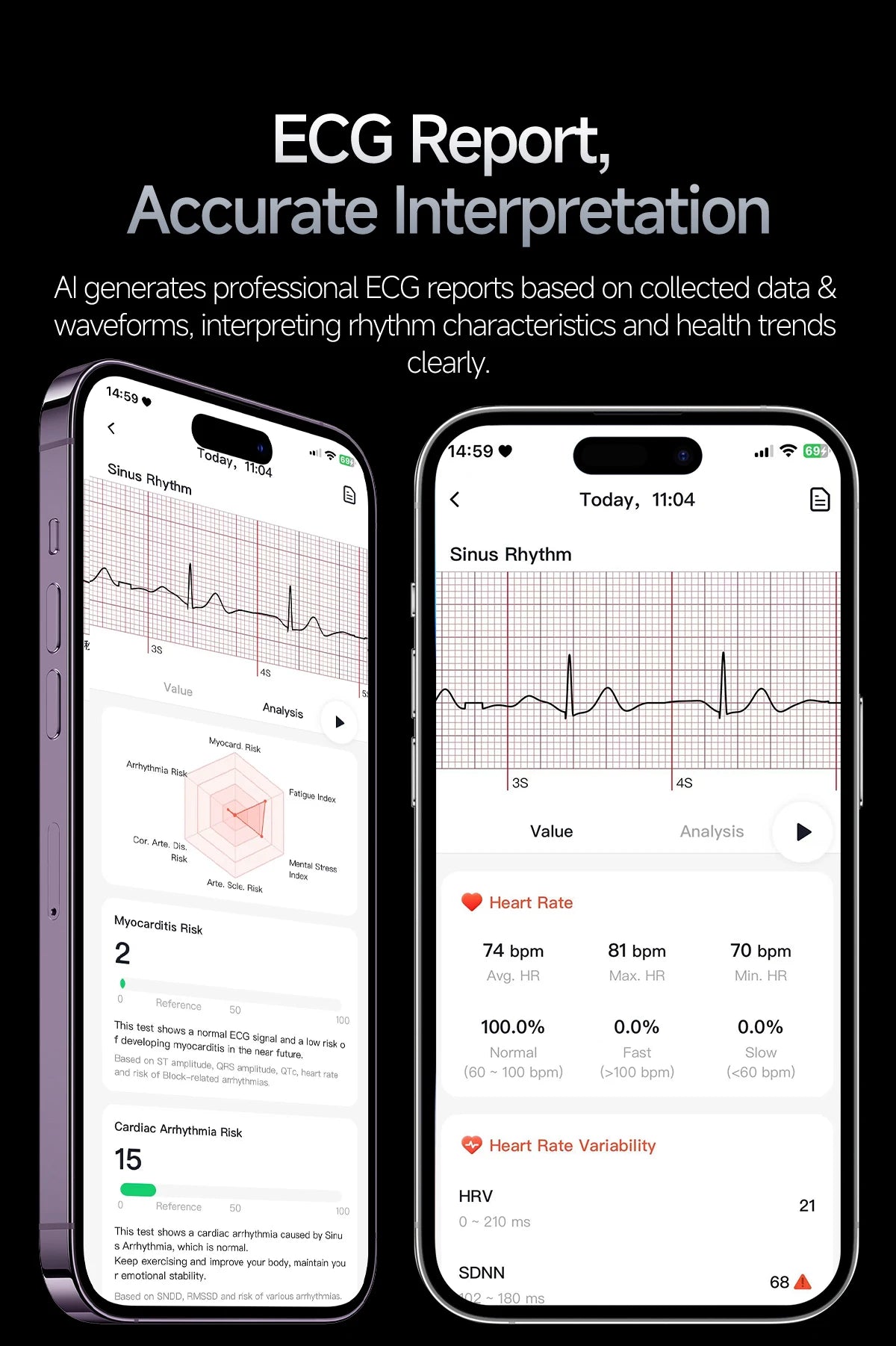 2026 New AI Health Care Accurate Detection ECG Smart Watch Blood Pressure lipids Uric Acid Analysis Bluetooth Call Smart Watches