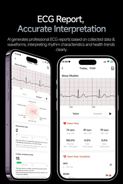 2026 New AI Health Care Accurate Detection ECG Smart Watch Blood Pressure lipids Uric Acid Analysis Bluetooth Call Smart Watches