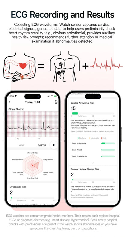 Nursing Grade New ECG+PPG Healthy Diagnose Smart Watch Men Body Analysis Blood Pressure Lipid Uric Acid NFC Health Tracker Watc