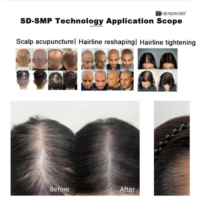 NUOJO Painless SMP Scalp Micropigmentation Machine PMU Micro Pigmentation Kit Scalp Tattoo Device Hair Tattoo Machine